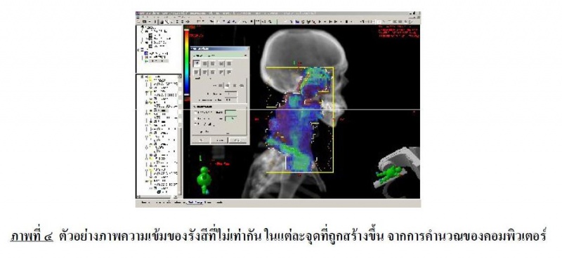 ไฟล์:ตัวอย่างภาพความเข้มของรังสีที่ไม่เท่ากัน.JPG